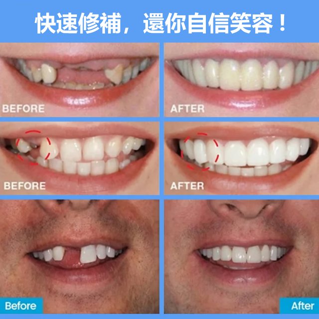 矽膠牙膠